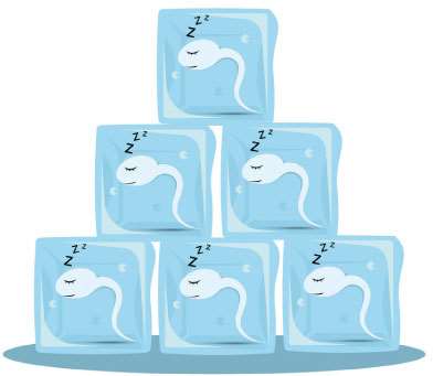 What is semen freezing?